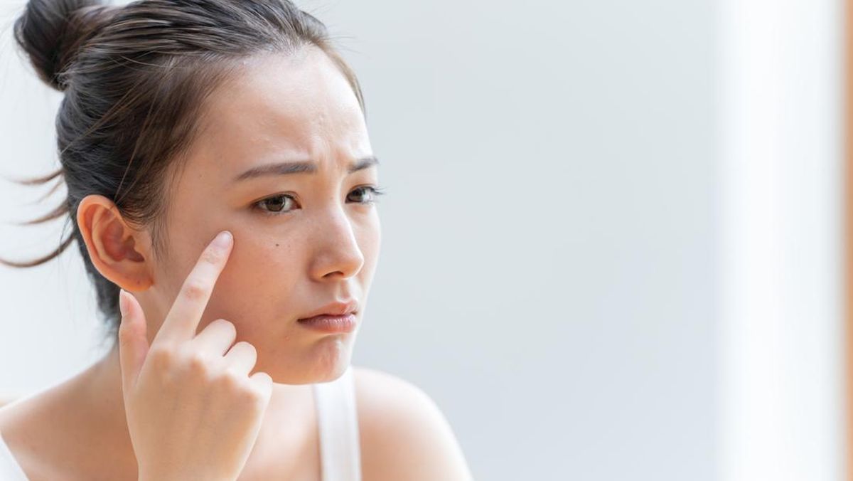 PERHATIKAN! Ini 5 Cara Merawat dan Memperbaiki Skin Barrier yang Rusak!